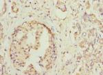 HOXD10 Antibody in Immunohistochemistry (Paraffin) (IHC (P))