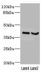 HOXD10 Antibody in Western Blot (WB)