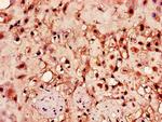 HPSE Antibody in Immunohistochemistry (Paraffin) (IHC (P))