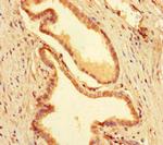 MEIS1 Antibody in Immunohistochemistry (Paraffin) (IHC (P))