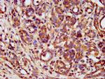 METAP1 Antibody in Immunohistochemistry (Paraffin) (IHC (P))