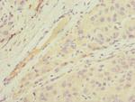 MGAT1 Antibody in Immunohistochemistry (Paraffin) (IHC (P))