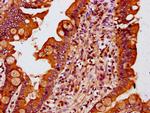 MTSS1 Antibody in Immunohistochemistry (Paraffin) (IHC (P))