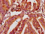 MTSS1 Antibody in Immunohistochemistry (Paraffin) (IHC (P))