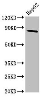 MTSS1 Antibody in Western Blot (WB)