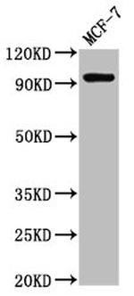 NCAM2 Antibody in Western Blot (WB)