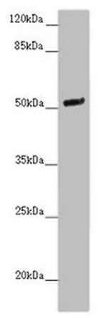 NOXA1 Antibody in Western Blot (WB)