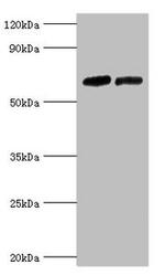 TR2 Antibody in Western Blot (WB)