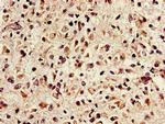 NTHL1 Antibody in Immunohistochemistry (Paraffin) (IHC (P))