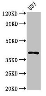 Opsin Blue Antibody in Western Blot (WB)