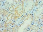 PARP3 Antibody in Immunohistochemistry (Paraffin) (IHC (P))