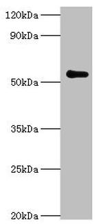 PARP3 Antibody in Western Blot (WB)