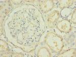 PBLD Antibody in Immunohistochemistry (Paraffin) (IHC (P))