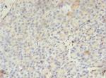 PMM1 Antibody in Immunohistochemistry (Paraffin) (IHC (P))