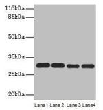 PMM1 Antibody in Western Blot (WB)