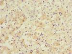 PPM1D Antibody in Immunohistochemistry (Paraffin) (IHC (P))