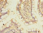 PPM1D Antibody in Immunohistochemistry (Paraffin) (IHC (P))