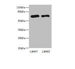 PPM1D Antibody in Western Blot (WB)