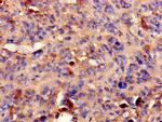 PPP2R2A Antibody in Immunohistochemistry (Paraffin) (IHC (P))