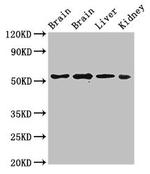 PPP2R2A Antibody in Western Blot (WB)