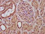 RFXANK Antibody in Immunohistochemistry (Paraffin) (IHC (P))