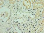 RGS20 Antibody in Immunohistochemistry (Paraffin) (IHC (P))