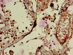 RNF126 Antibody in Immunohistochemistry (Paraffin) (IHC (P))