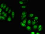 RPL23A Antibody in Immunocytochemistry (ICC/IF)