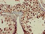 RPL23A Antibody in Immunohistochemistry (Paraffin) (IHC (P))