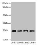 RPS8 Antibody in Western Blot (WB)