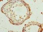 Rhotekin Antibody in Immunohistochemistry (Paraffin) (IHC (P))