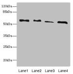 Rhotekin Antibody in Western Blot (WB)