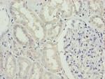 SDSL Antibody in Immunohistochemistry (Paraffin) (IHC (P))