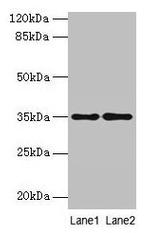 SDSL Antibody in Western Blot (WB)