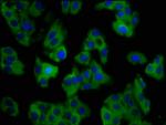 SLC11A1 Antibody in Immunocytochemistry (ICC/IF)