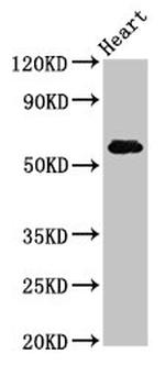 SLC11A1 Antibody in Western Blot (WB)