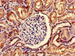 SNRPD1 Antibody in Immunohistochemistry (Paraffin) (IHC (P))