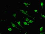 SOX9 Antibody in Immunocytochemistry (ICC/IF)