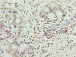 SYNJ2BP Antibody in Immunohistochemistry (Paraffin) (IHC (P))