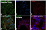 IFITM3 Antibody in Immunocytochemistry (ICC/IF)