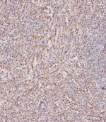 IFITM3 Antibody in Immunohistochemistry (Paraffin) (IHC (P))