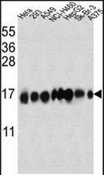 IFITM3 Antibody in Western Blot (WB)