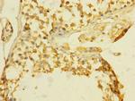 TGFBR3 Antibody in Immunohistochemistry (Paraffin) (IHC (P))