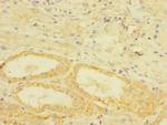 TGFBR3 Antibody in Immunohistochemistry (Paraffin) (IHC (P))