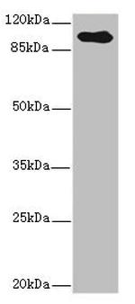 TGFBR3 Antibody in Western Blot (WB)