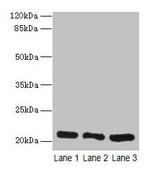 GM2A Antibody in Western Blot (WB)