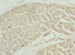 TNNI2 Antibody in Immunohistochemistry (Paraffin) (IHC (P))