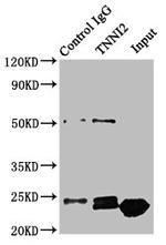 TNNI2 Antibody in Immunoprecipitation (IP)