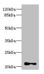 TNNI2 Antibody in Western Blot (WB)