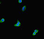 TOX3 Antibody in Immunocytochemistry (ICC/IF)